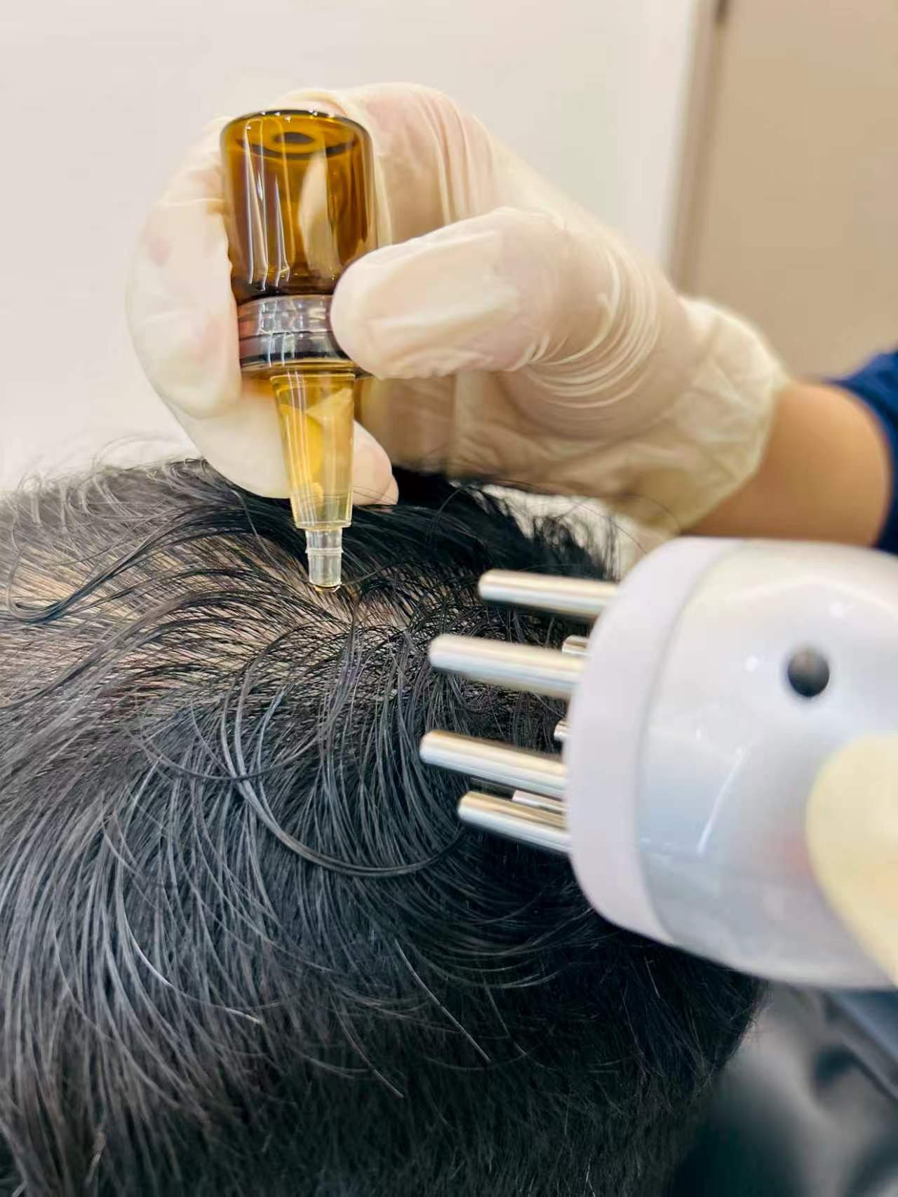 头皮深层清洁